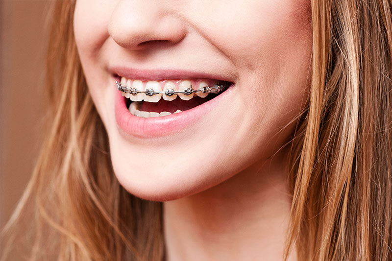 Orthodontics in Socorro